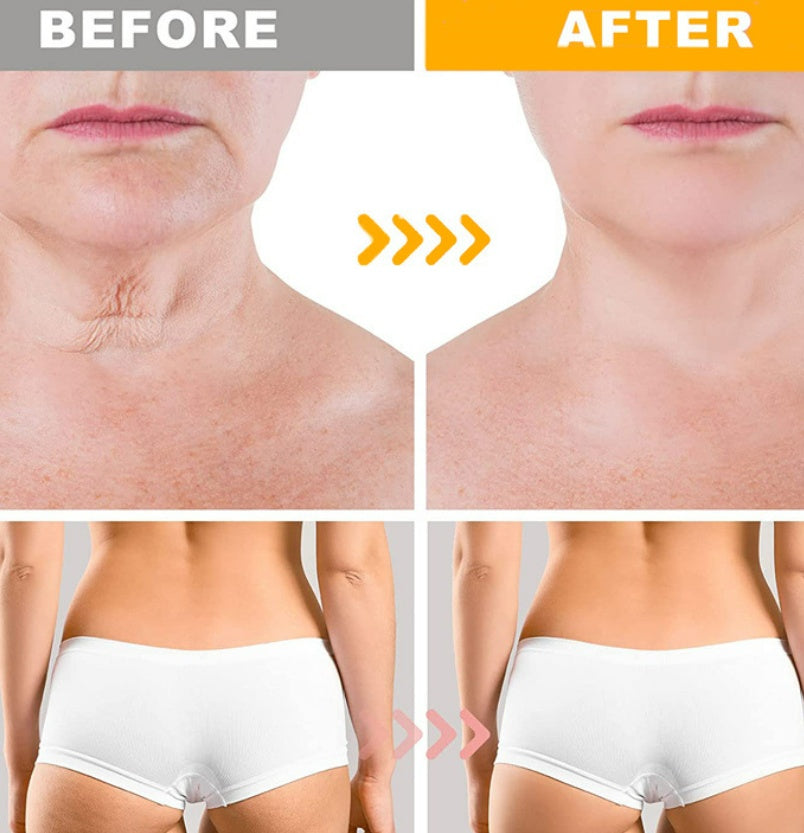Crazylife Bee Venom Dual-purpose Body Face Repair Cream
