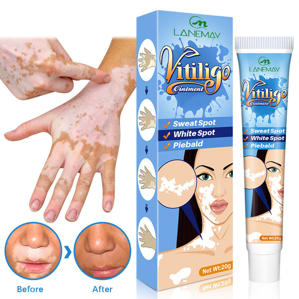 Vitiligo Sweat Spotted Skin Care Repair Cream