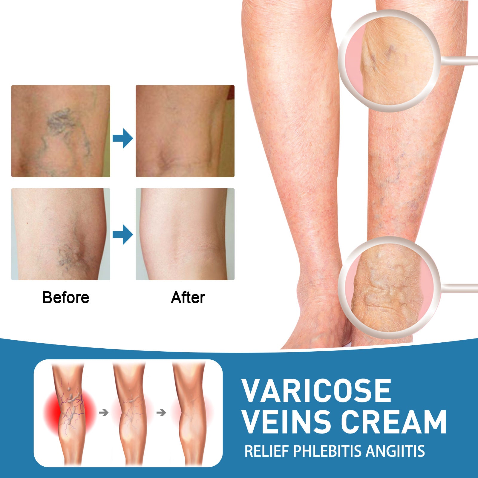 Intravenous Repair Cream Relieve Leg Pain Leg Massage Soreness Maikang Neck Cream