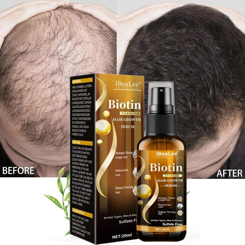 iBeaLee Anti Hair Loss Hair Nourishing Liquid Hair Firming And Hair Increasing