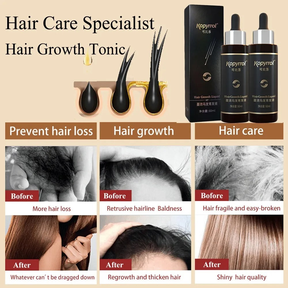 Kopyrrol Hair Root Eyelash Growth Liquid Hair Growth Hair Renewal Liquid