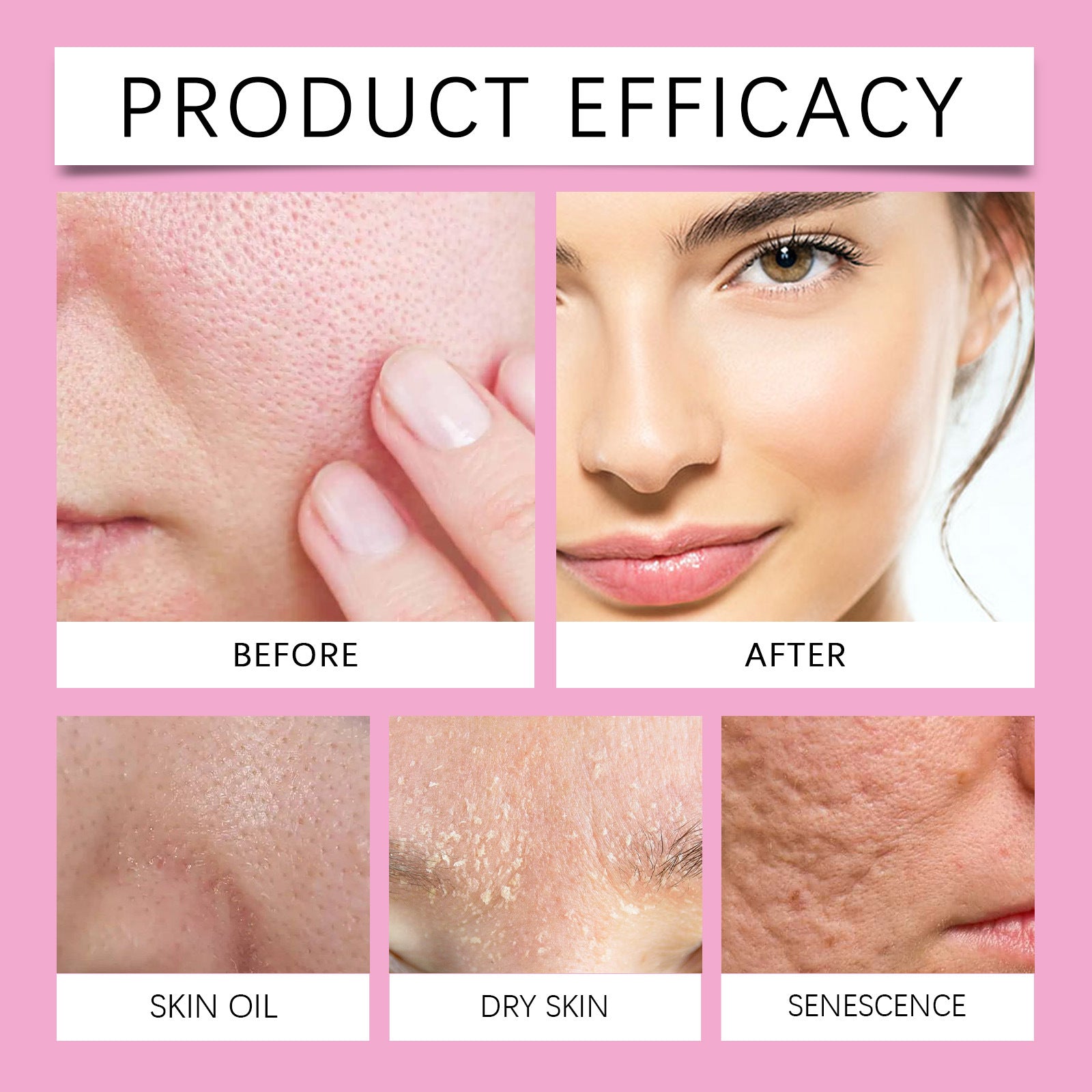 Tightening And Anti Wrinkle Eye Cream