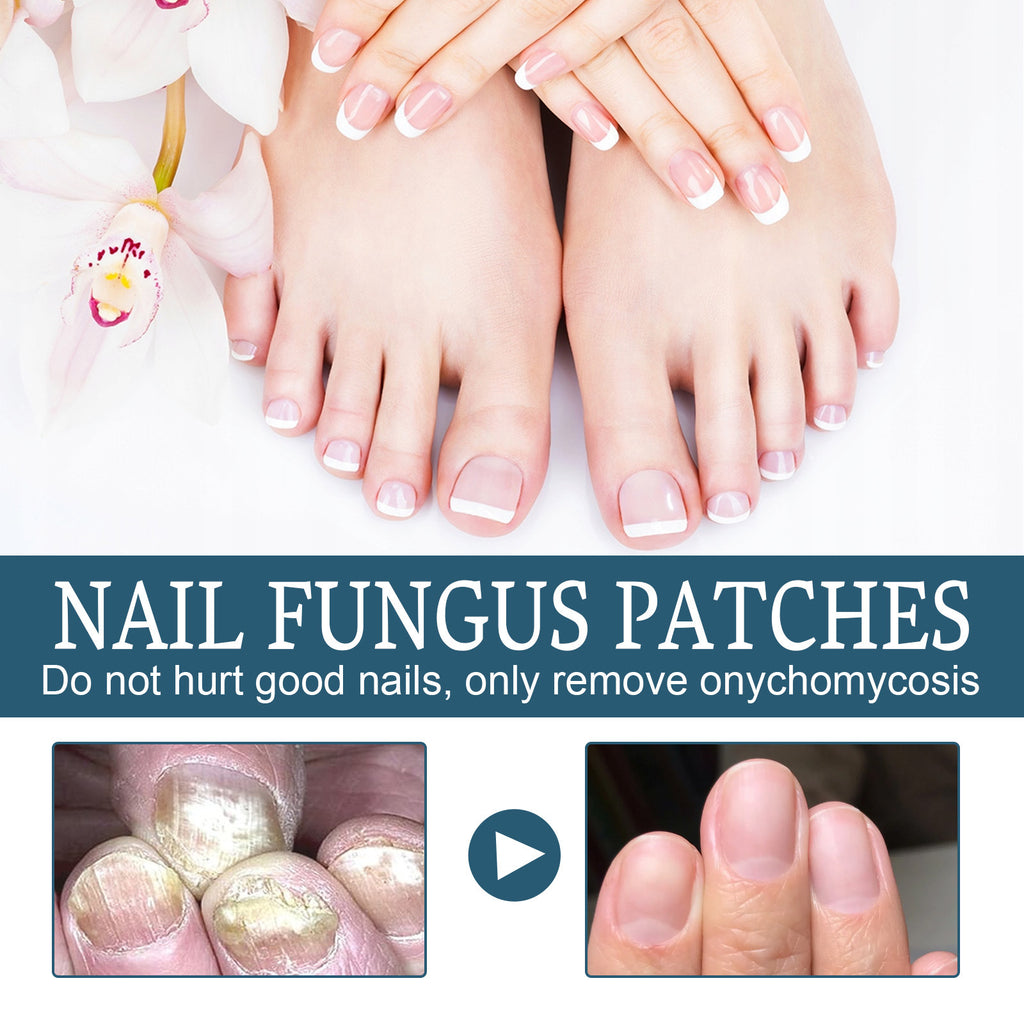 Ximonth Nail Repair Embedded Thickening Bright Nail