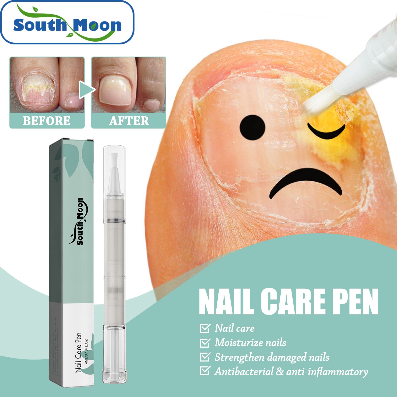 South Moon Nail Repair Pen Nail Removal Dead Skin Barbed Gray Nail Care Nutrition Moisturizing Repair Pen