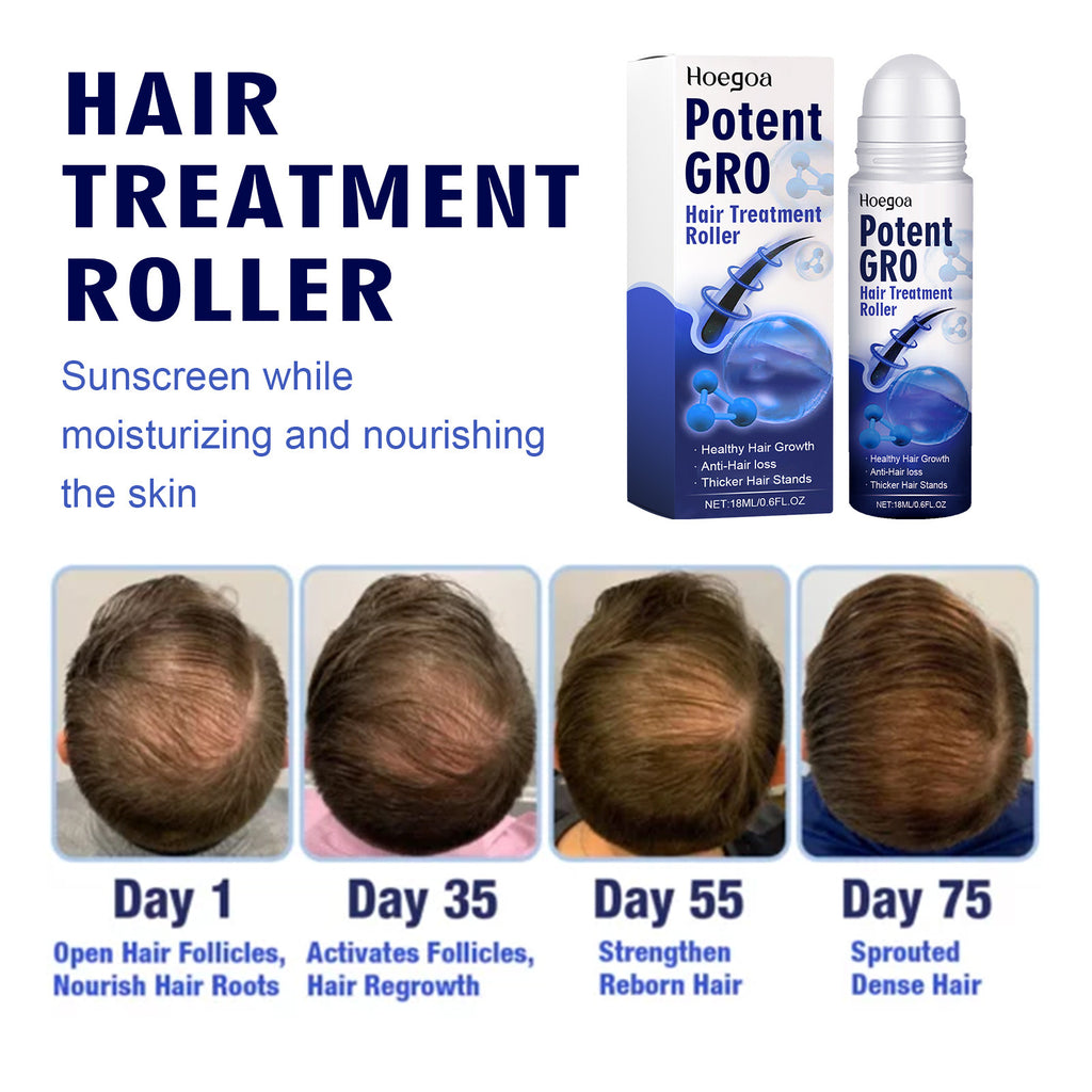 HoeGoa Hair Care Roller Repair Strong And Firm Hair Moisturizing Hair Root