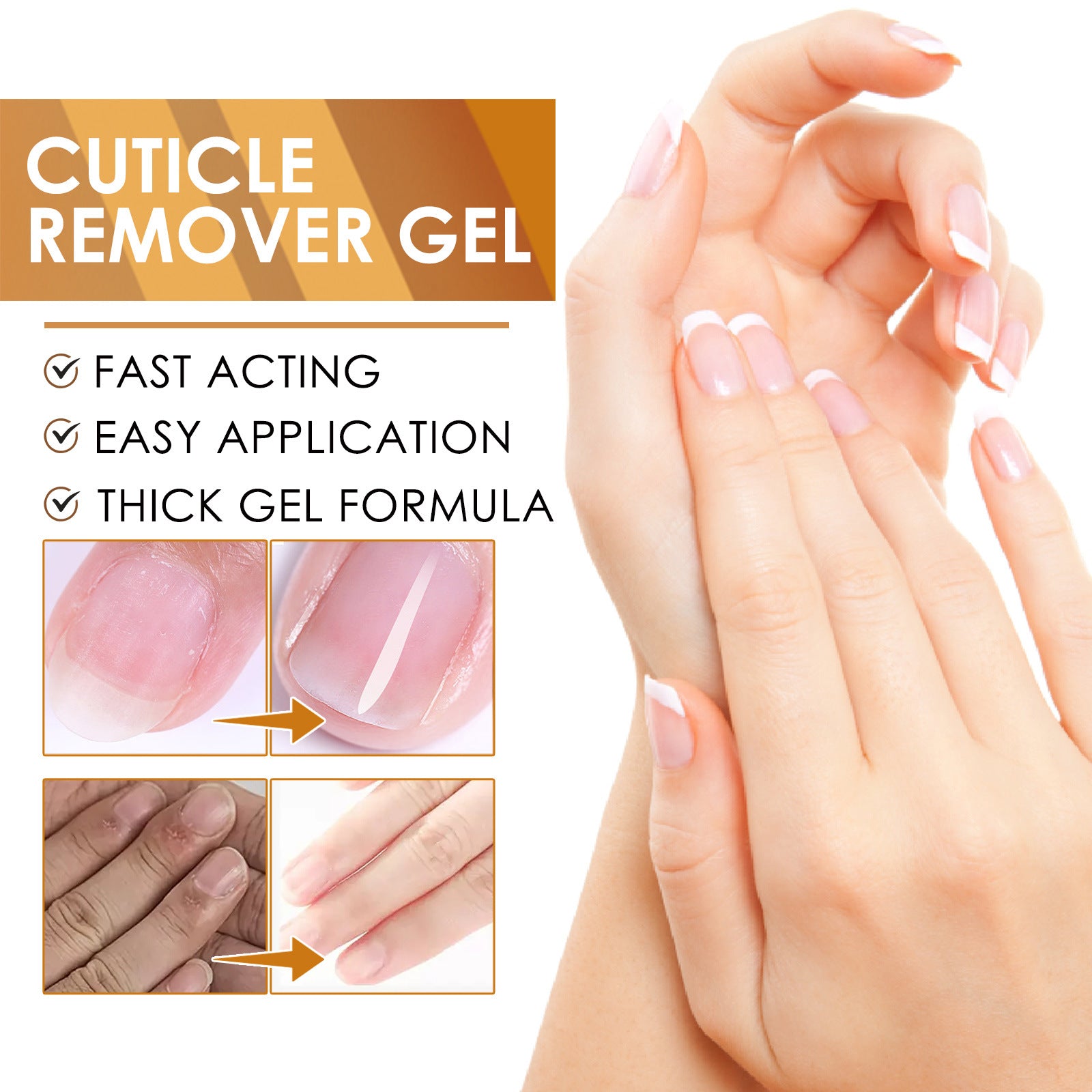 Eelhoe Repair Gray Nail Soft Nail Rotten Nail Dead Skin Moisturizing Care Solution