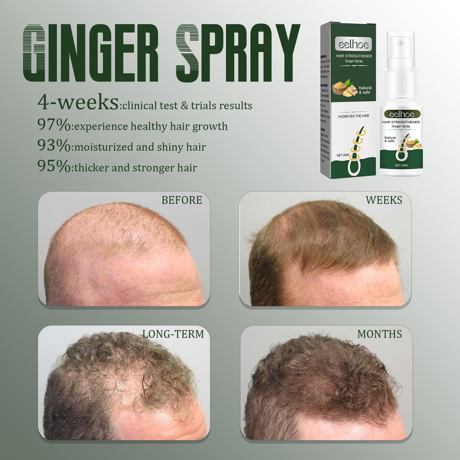 Eelhoe Hair Breaking And Nourishing Ginger Hair Sealing Spray