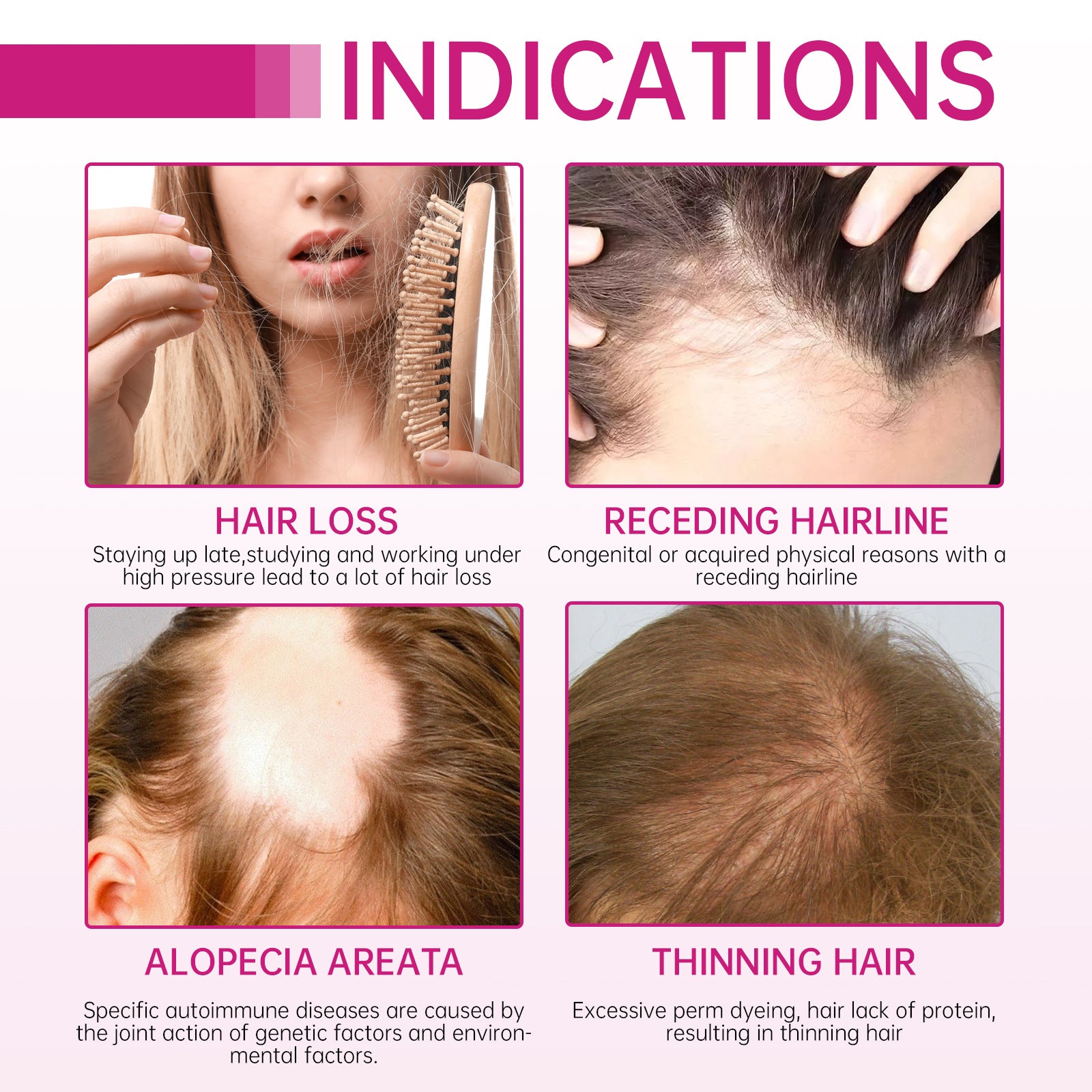 Yilest Hair Care Capsule Vitamin Hair Moisturizing