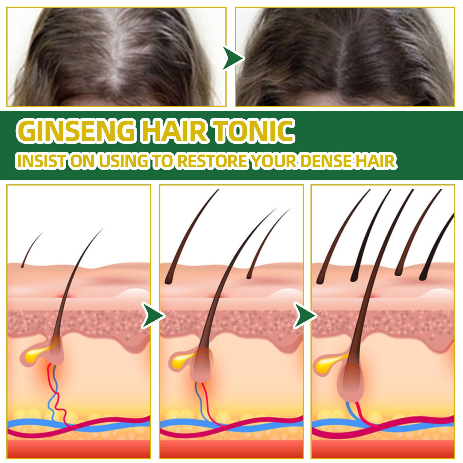 Ouhoe Ginseng Hair Growth Liquid Spray To Prevent Hair Loss