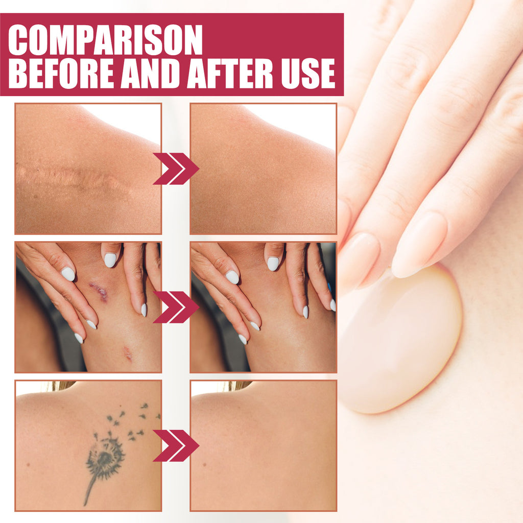 Body Makeup Liquid Foundation Cover Fleck Moisturizing Lasting