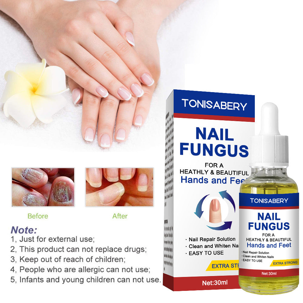 TonisaBery Nail To Remove Nails30 Ml