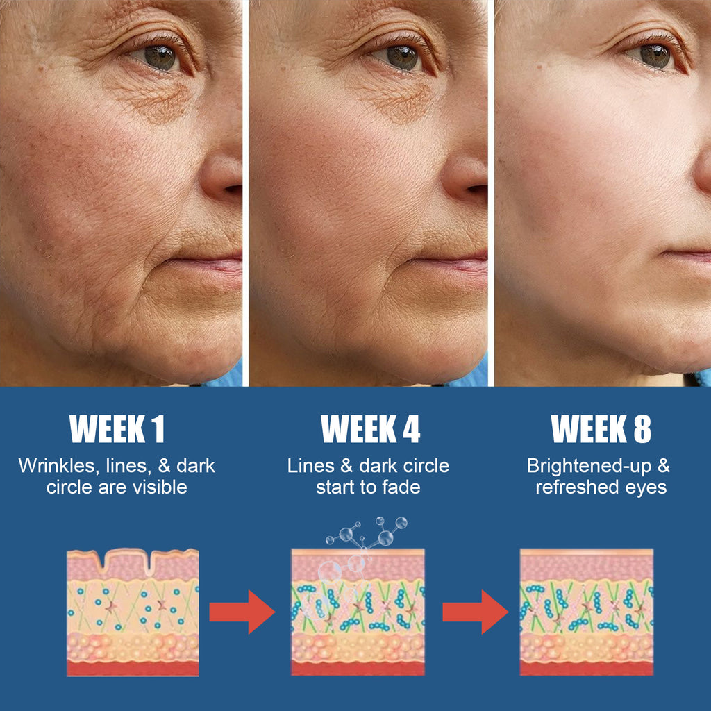 New Hyaluronic Acid Moisturizing Eye Cream
