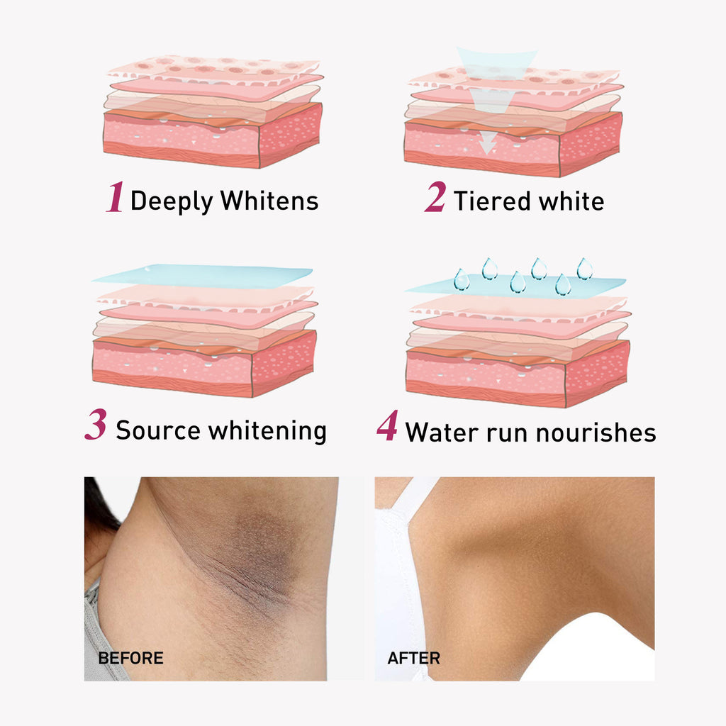 Underarm Melanin Nourishing Moisturizing Skin Rejuvenation Cream