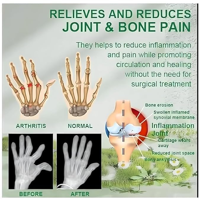 Bee Venom Joint and Bone Therapy Cream (Pack Of 3)