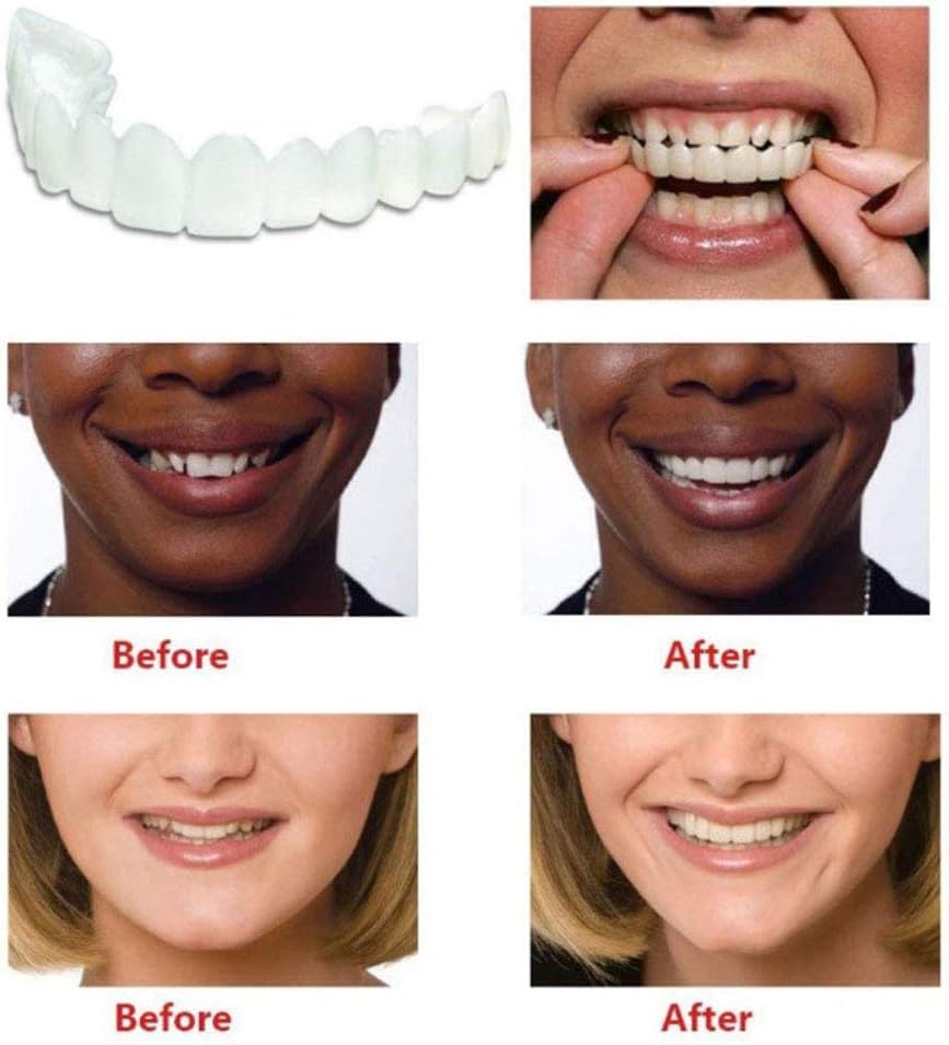 Top and Bottom Denture Teeth Socket (Pack of 1)