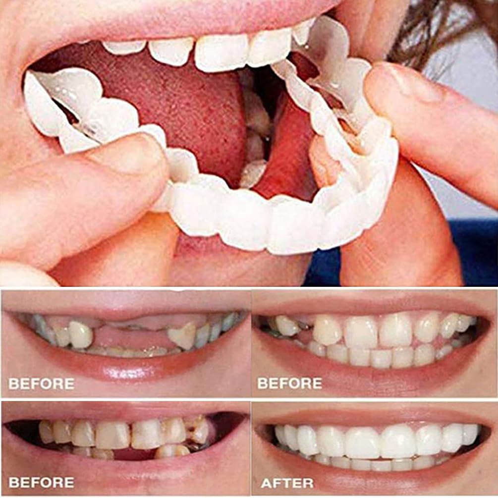 Top and Bottom Denture Teeth Socket (Pack of 1)