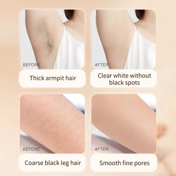 Hair Removal and Suppression Smooth Skin 250ML (Pack Of 2)