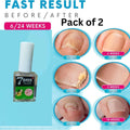 7 Days Nail Fungus Treatement Polish (Pack Of 2)