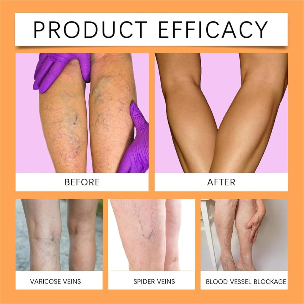 Turmeric Varicose Vein Patch Pack of 2(Each Pack 10 Piece)
