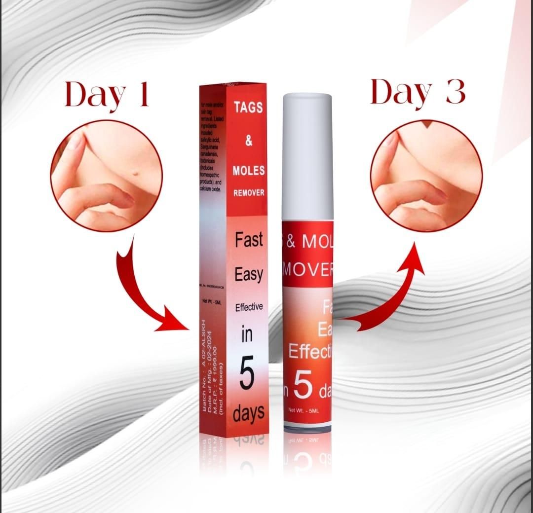Wipe Off Tags & Mole Remover (BUY 1 GET 1 FREE)