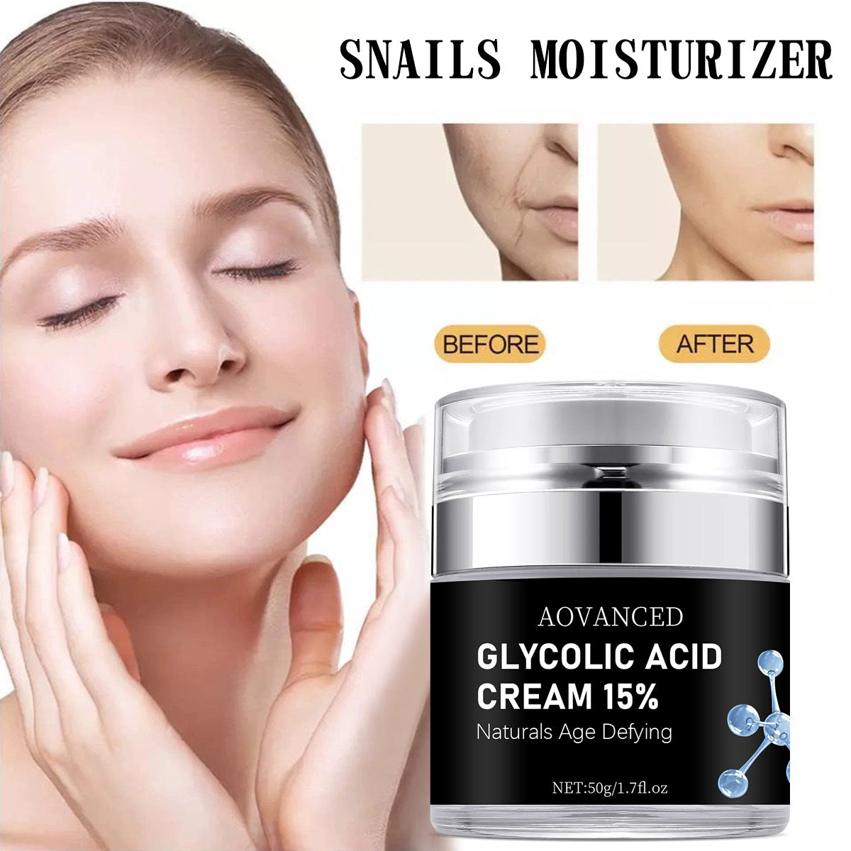 Exfoliating Smallpox Diluting Salicylate Nourishing Moisturizing Cream