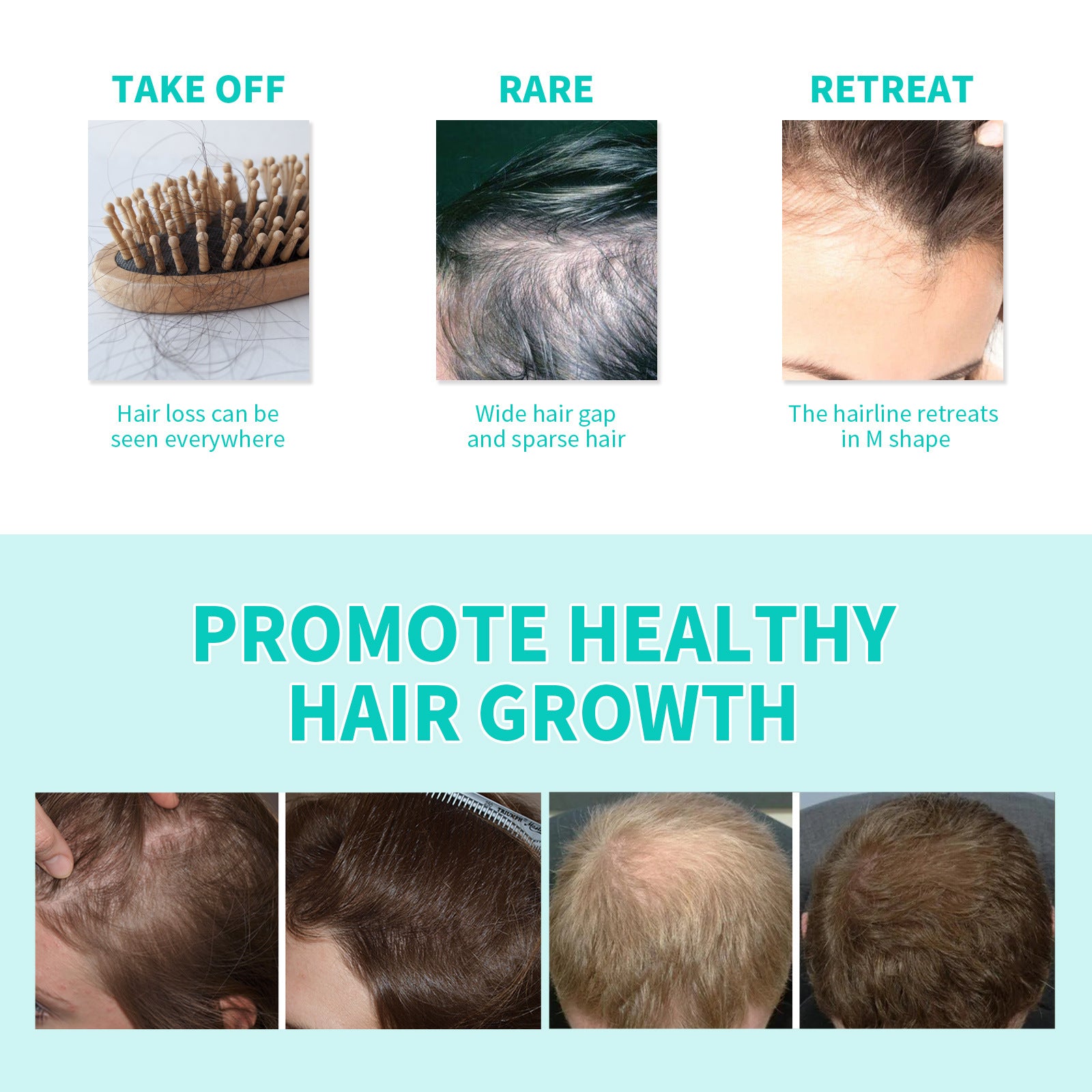 Ouhoe Dense Hair Ball Strong Hair Care