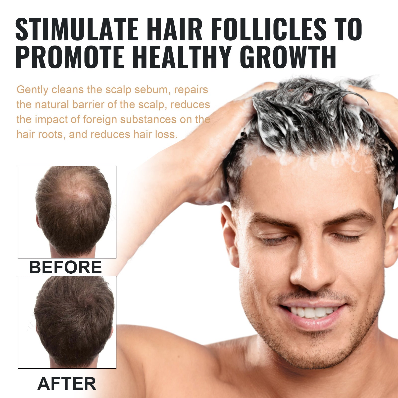Anti-hair Loss Solid Thick Fluffy Hair Soft Strong Repair Shampoo