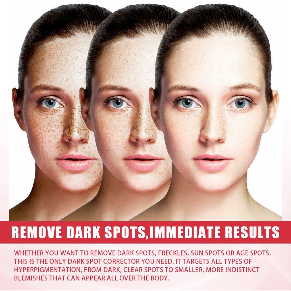 Tianqu Acid Moisturizing Cream Moisturizing Desalination