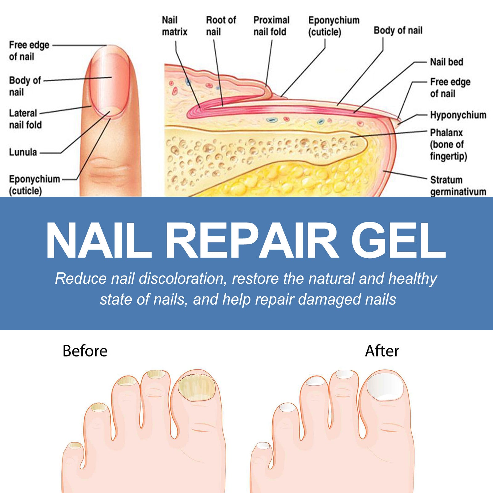 Ouhoe Nail Fungus Care Gel Repair