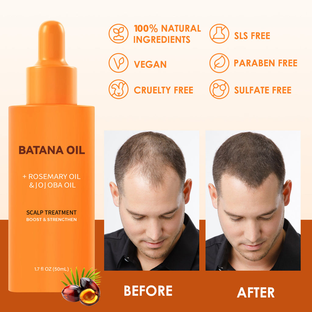 Batana Oii Hair Care Supple Hair Repair Dry
