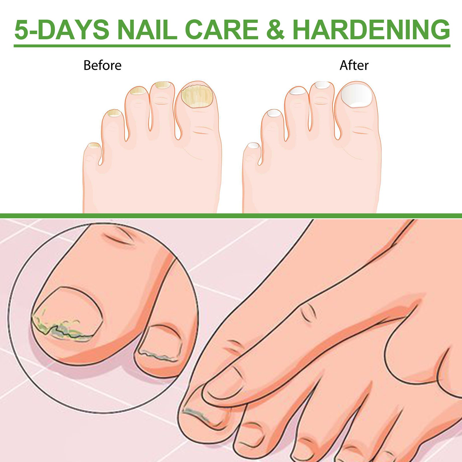 South Moon Nail Repair Roller Gray Thickening Nail Care Solution