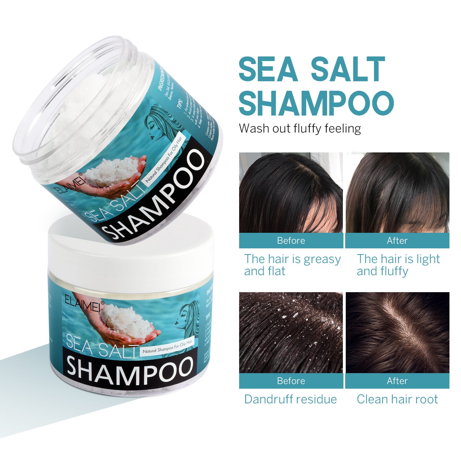 Anti Dandruff And Oil Control Hair Cream