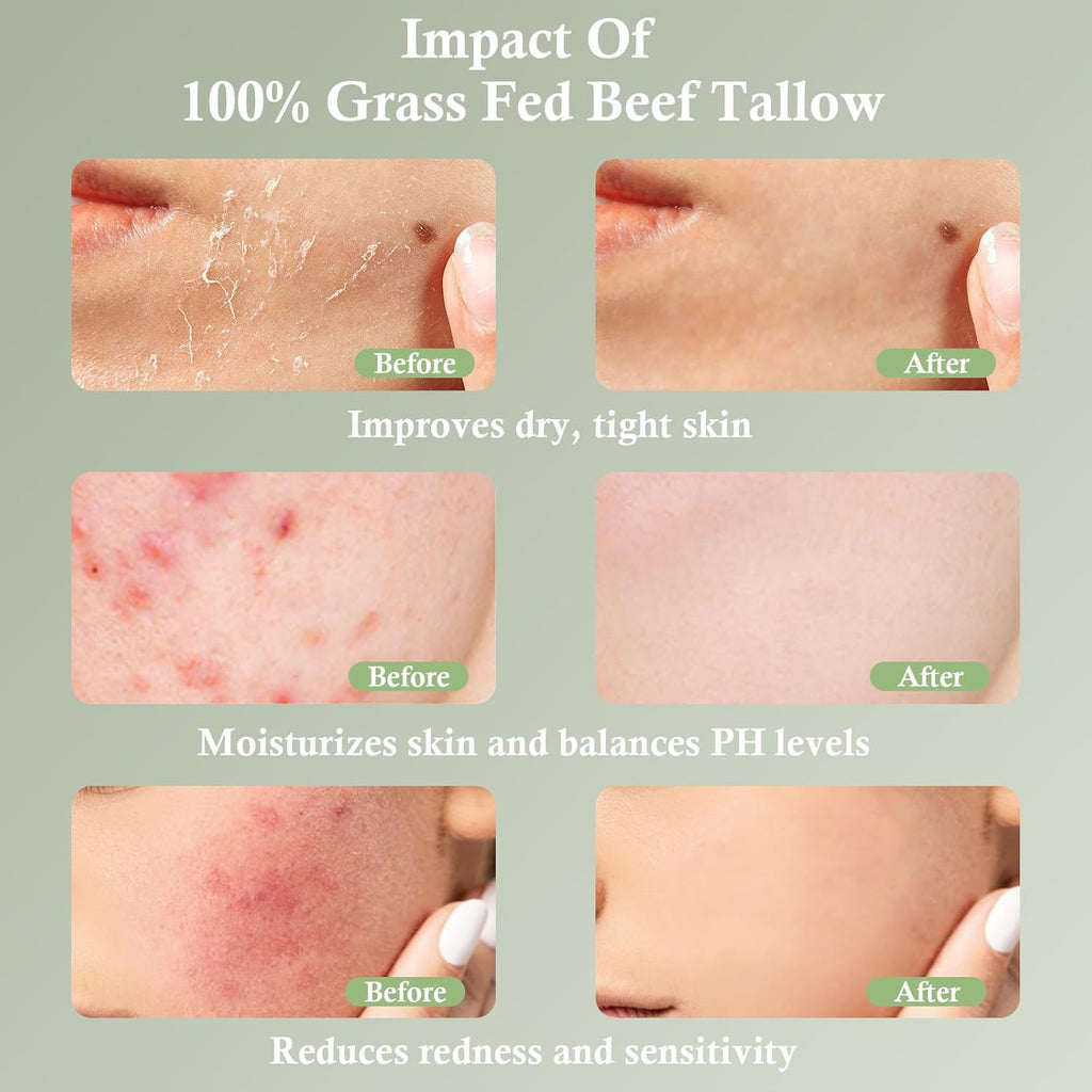 Tallow Skin Moisturizing Cream Grass-fed Tallow Soothing Nourishing Moisturizing Cream