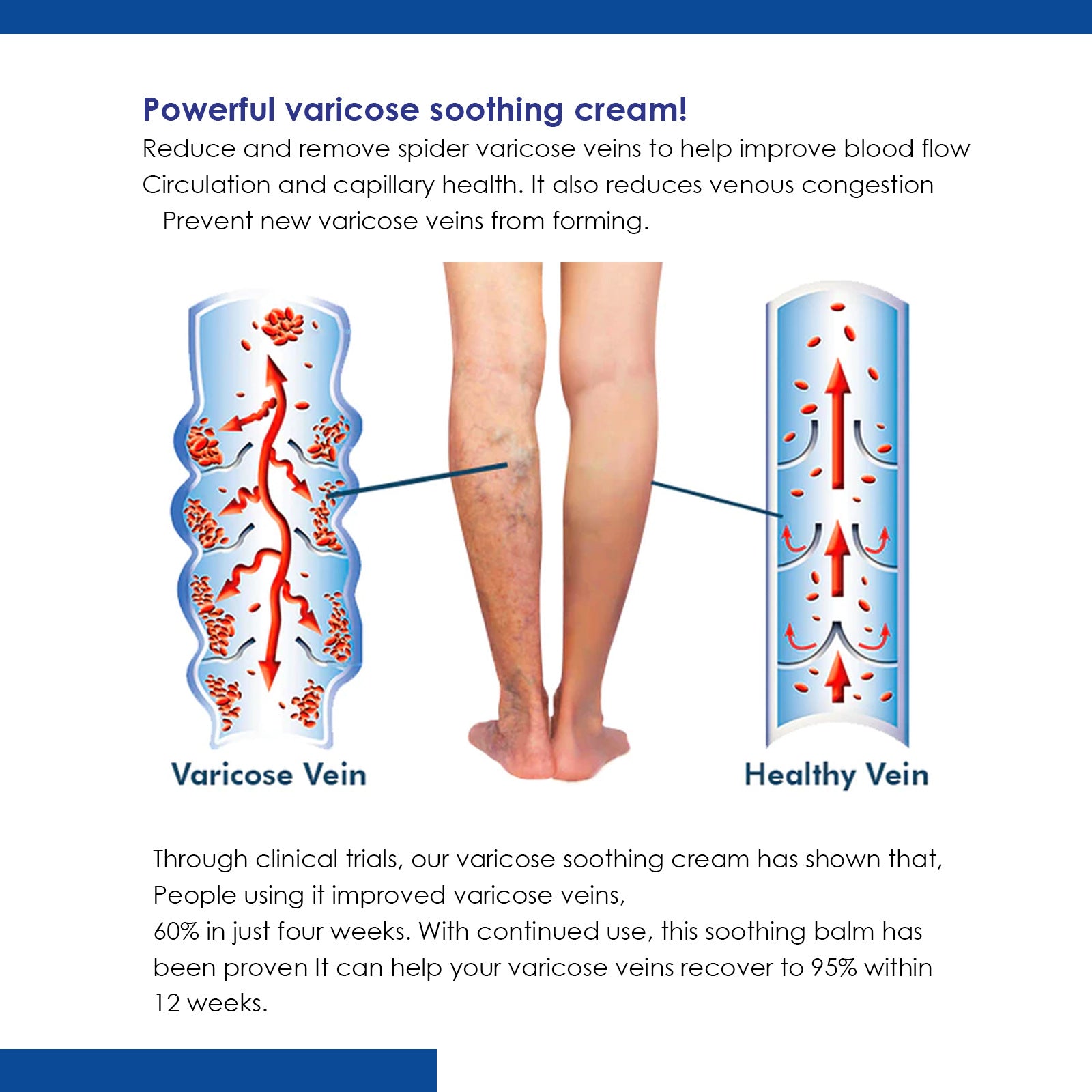 Leg Neck Cream Relieve Discomfort Care Moisturizing