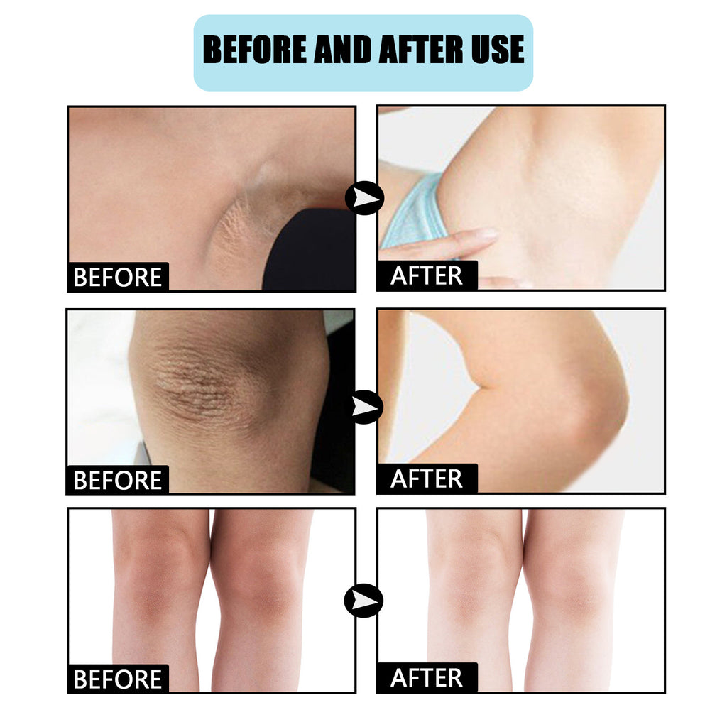 Underarm Moisturizing Concealer Brightening Beauty Cream