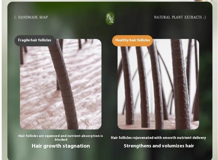 Oil Control And Dandruff Removal Soap Chinese Arborvitae Twig Shampoo