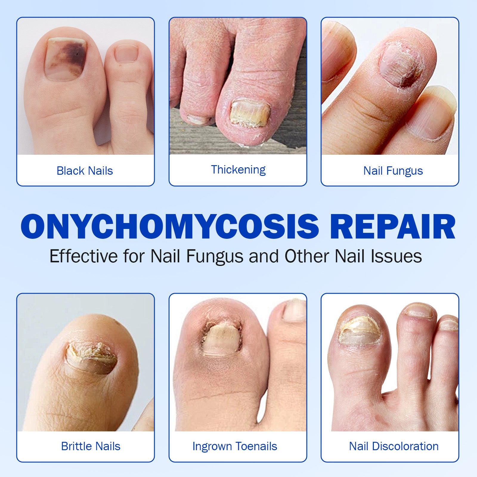 Elaimei Nail Antibacterial Patch Strengthening Health Patch