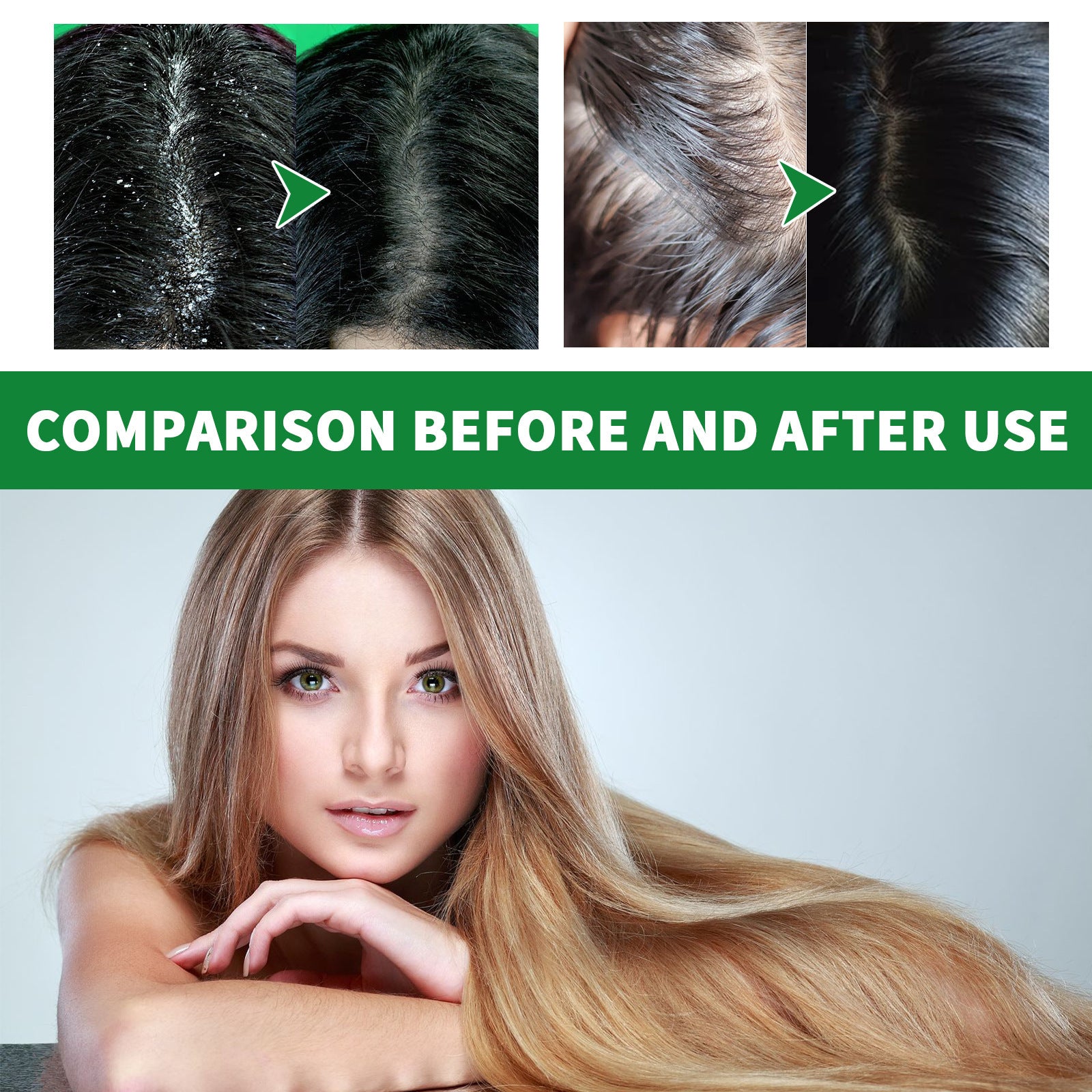 Jaysuing Cleansing Scalp Dandruff Soft Fluffy Shampoo