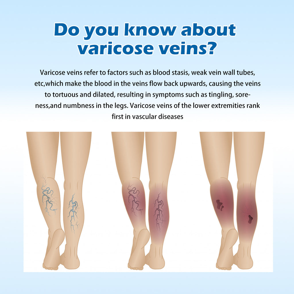 OUHOE Vein Slimming Cream Vein Repair Body Care