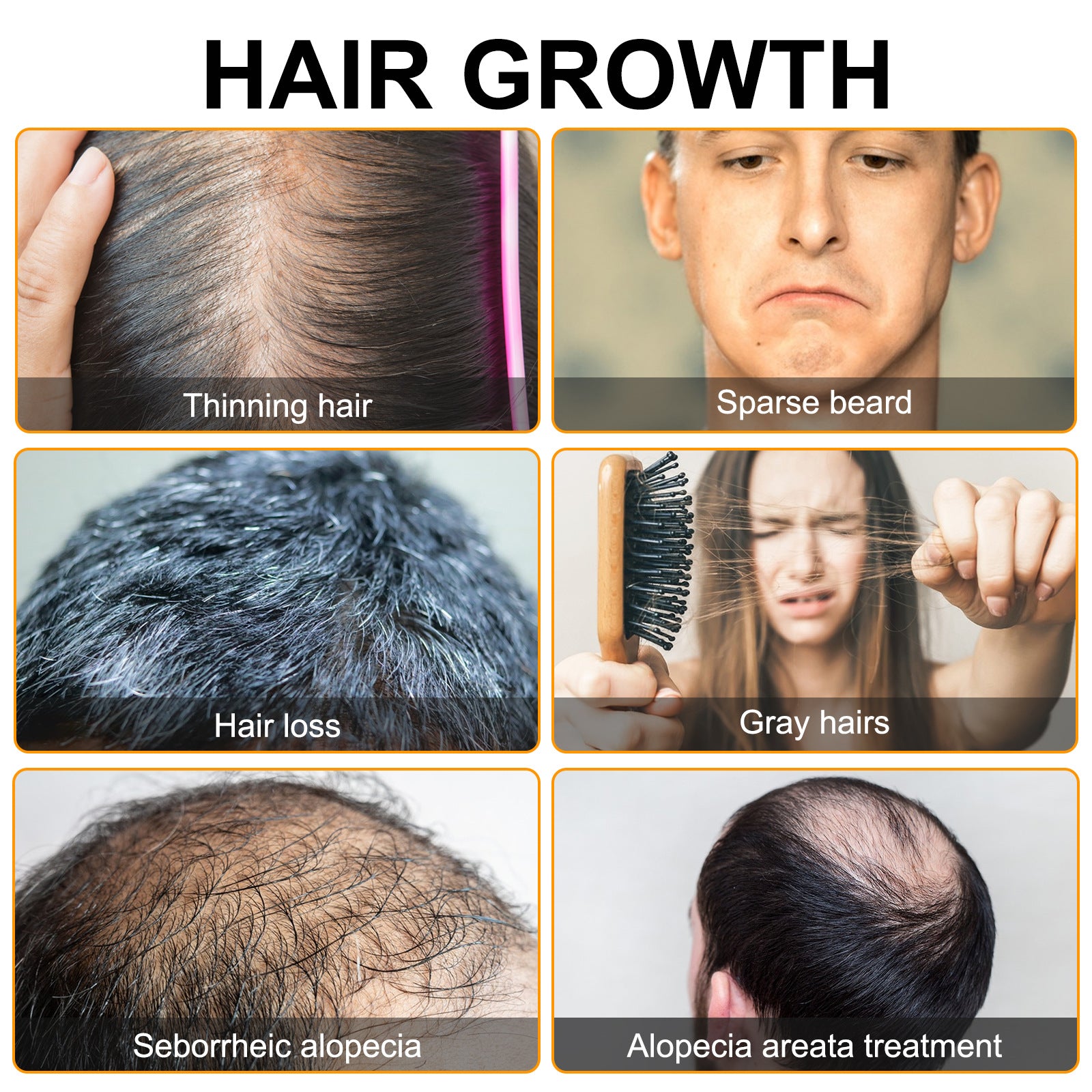 ELAIMEI Hair Growth Moisturizing The Scalp And Preventing Hair Loss