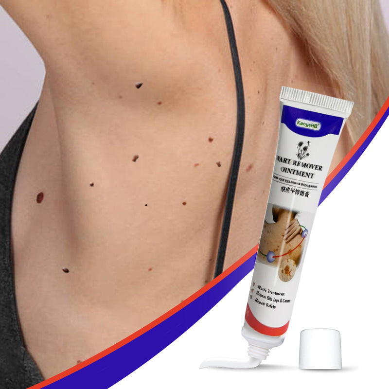 Wart Remover Cream Flat Monkey Yo Wart Removal Cream