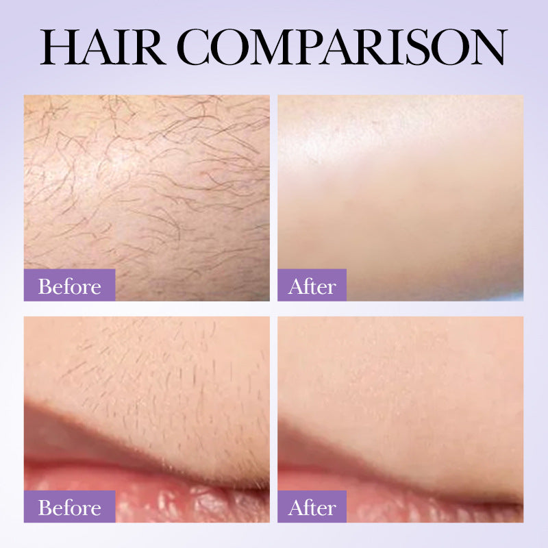 Sadoer Hair Growth Inhibition Armpit Leg Hair Spray