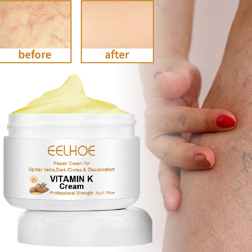 Bulge And Swelling Of Legs Repair Cream