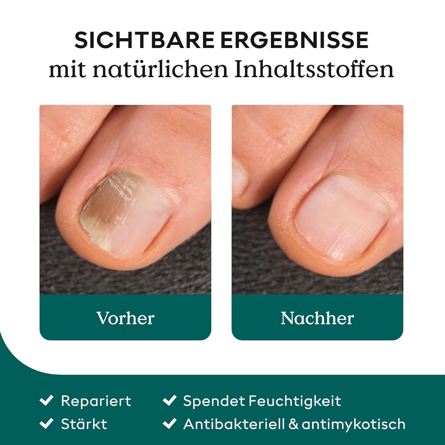 NaoilMatrix Gentle Moisturizing Cleansing, Hydrating And Moisturizing Hand And Foot Care