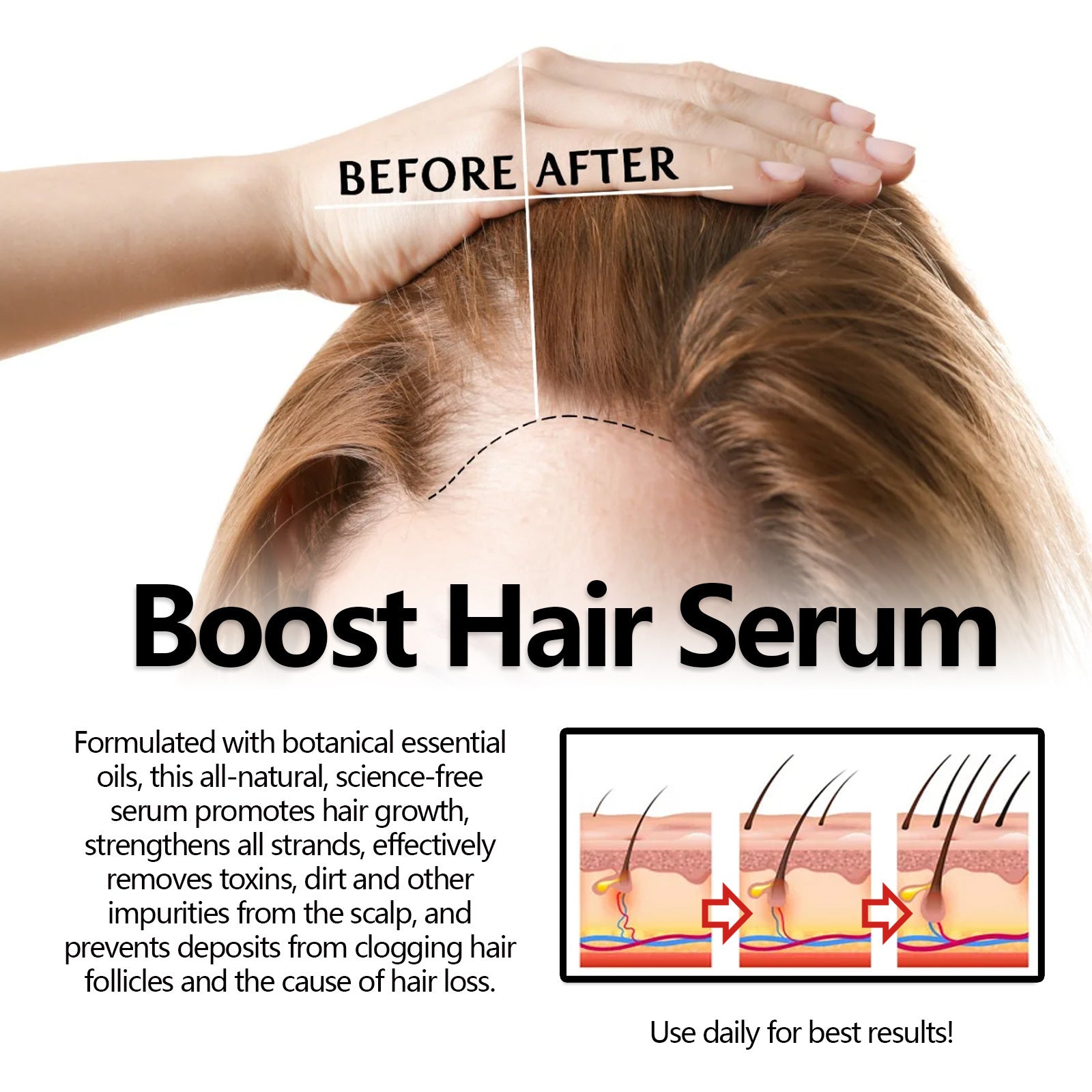 Eelhoe Herbal Hair Care Solution Anti-hair Loss And Strong