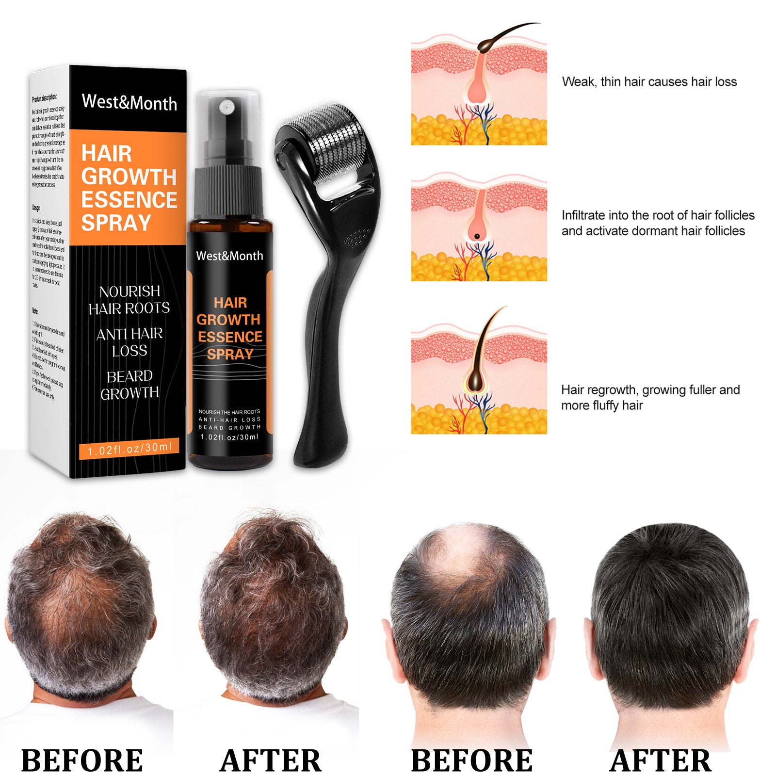 West&Month Hair Growth Spray Anti-hair Nourishing Growth Liquid