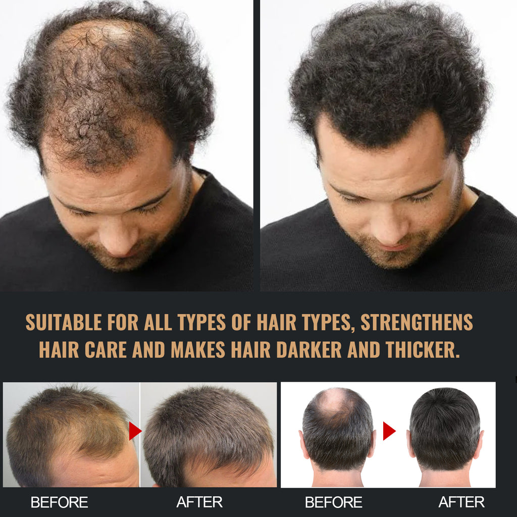 Anti-hair Loss Solid Thick Fluffy Hair Soft Strong Repair Shampoo