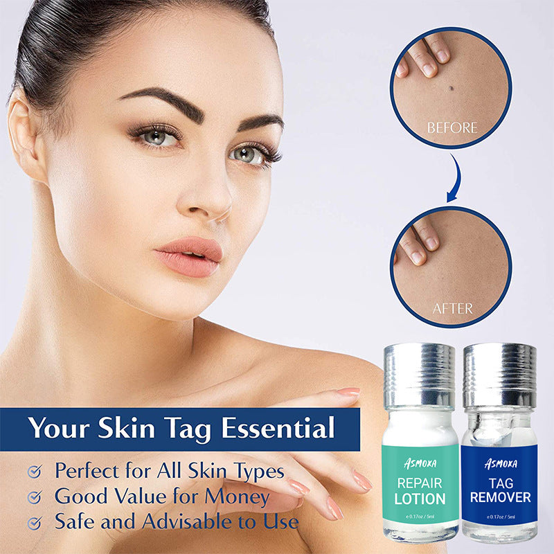 Mole Remover Cream Wart Removal Solution Without Pit