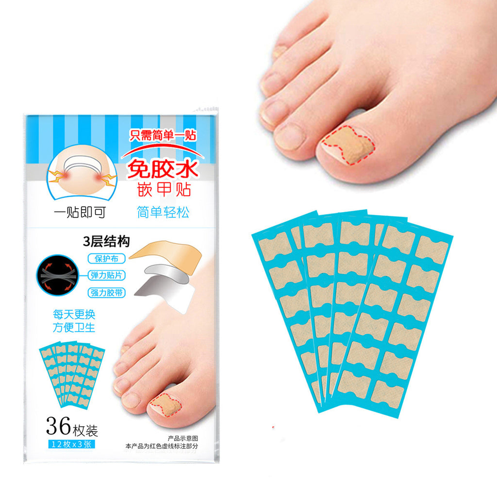 So Easy Inlay Nail Paste Double-sided Tape Inlay Nail Corrector Tool