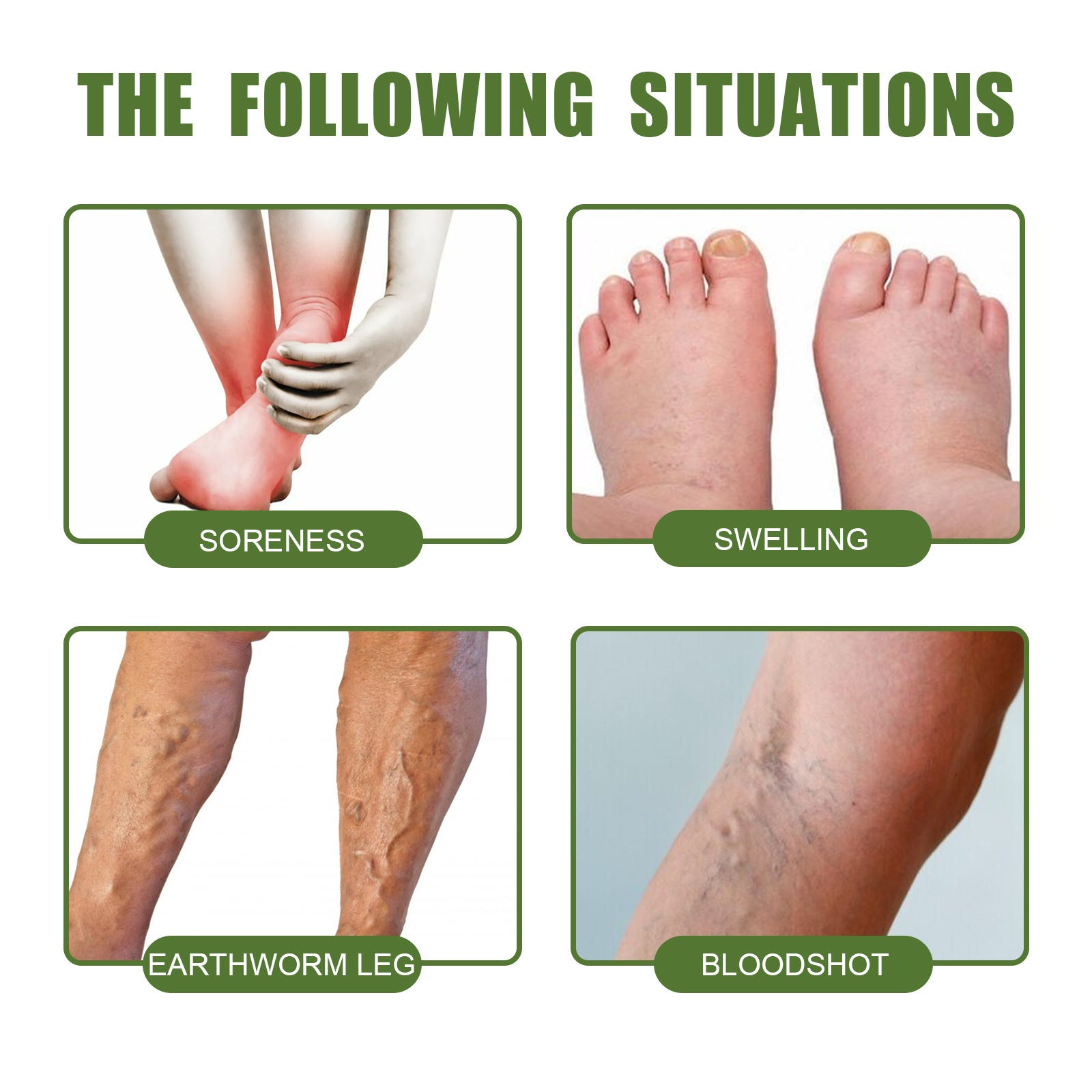 Leg Curved Earthworm Leg Massage Neck Cream